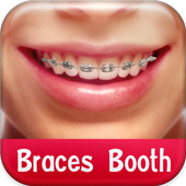 Braces Booth 1.8